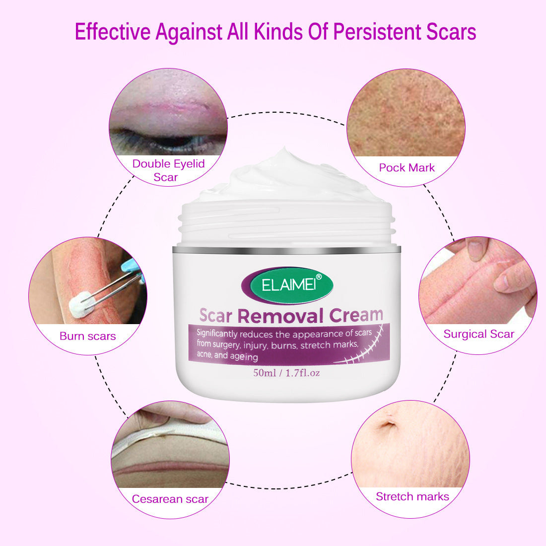 Skin Rebound Scarless Cream Scar Removal Cream Face Cream For Face Acne Scar Stretch Marks Skin Repair Face Cream Skin Rebound Scarless Cream Scar Removal Cream Face Cream For Face Acne Scar Stretch Marks Skin Repair Face Cream